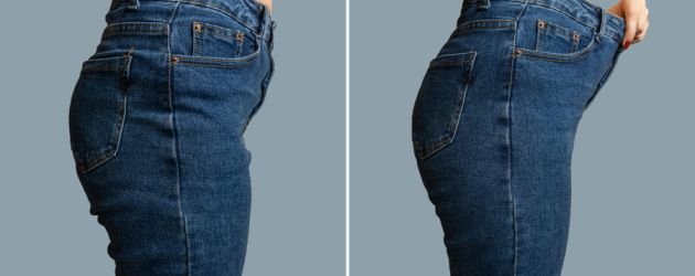 Before and after photo aesthetics care